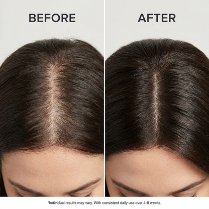 Before and after results of using Carefy scalp massage brush showing improved hair thickness and density